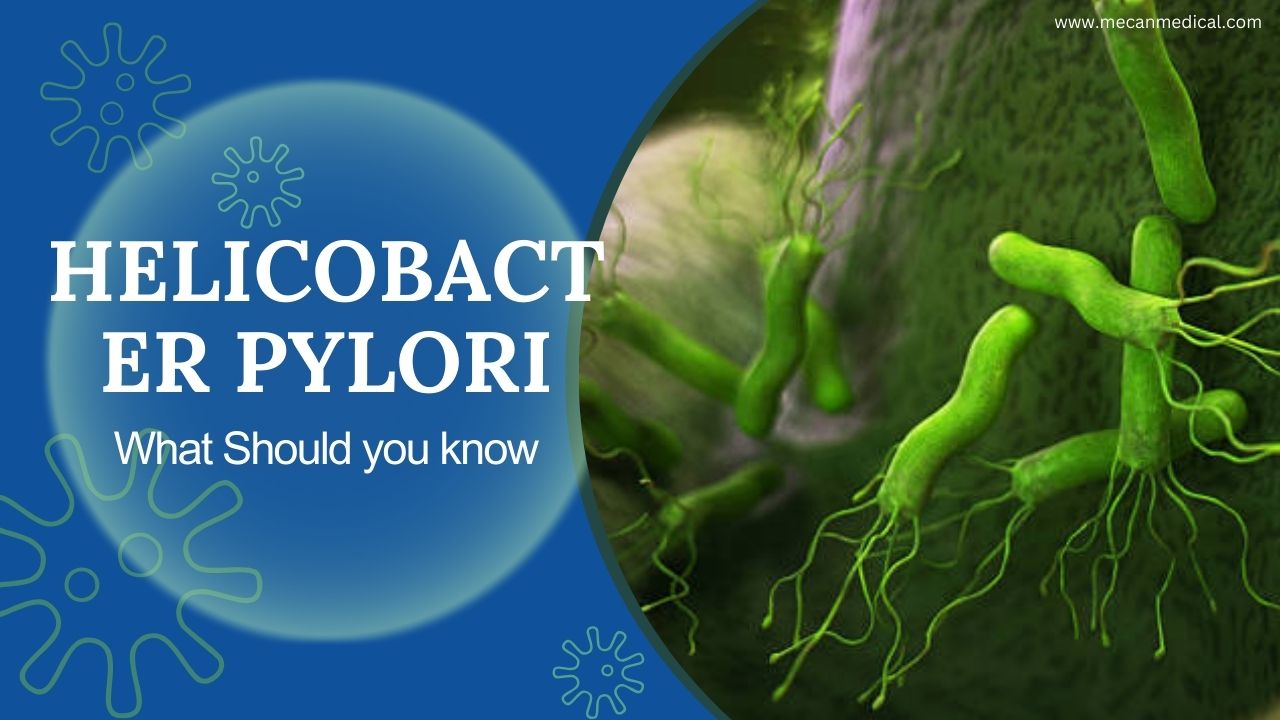 What Should You Know of Helicobacter Pylori