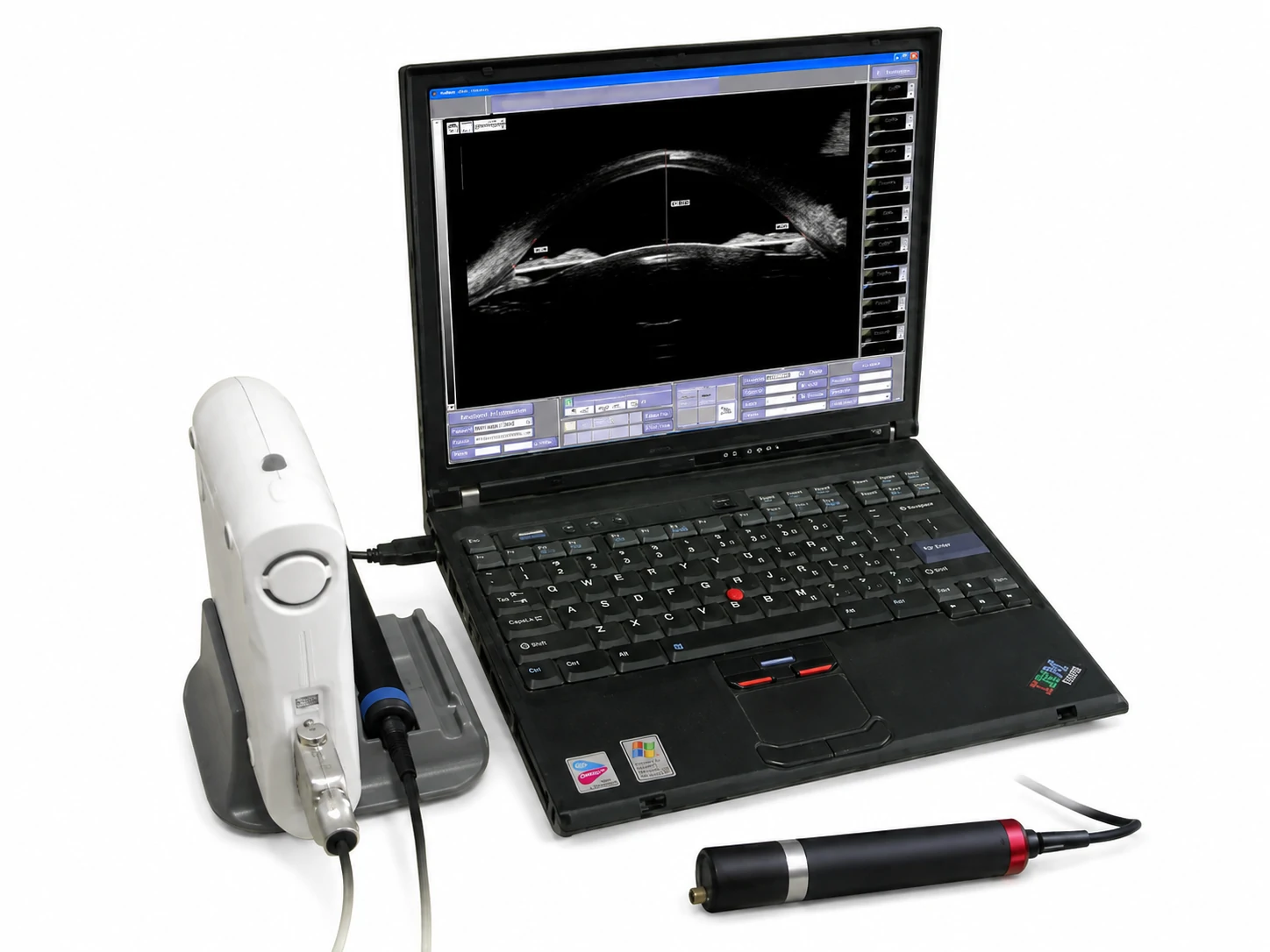 Ophthalmology ultrasound diagnosis