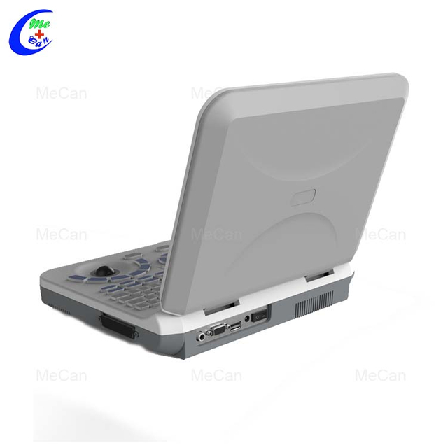 Laptop Ultrasound - Portable and Efficient