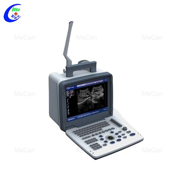 Portable Ultrasound Machine - Sale