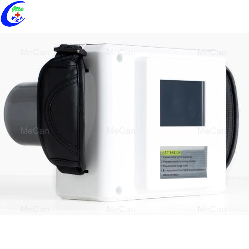 portable dental x-ray