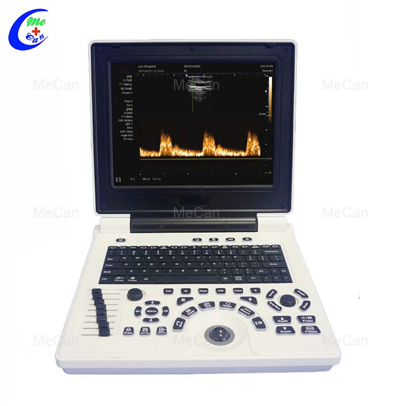 Color Doppler Ultrasound - Fetal Imaging