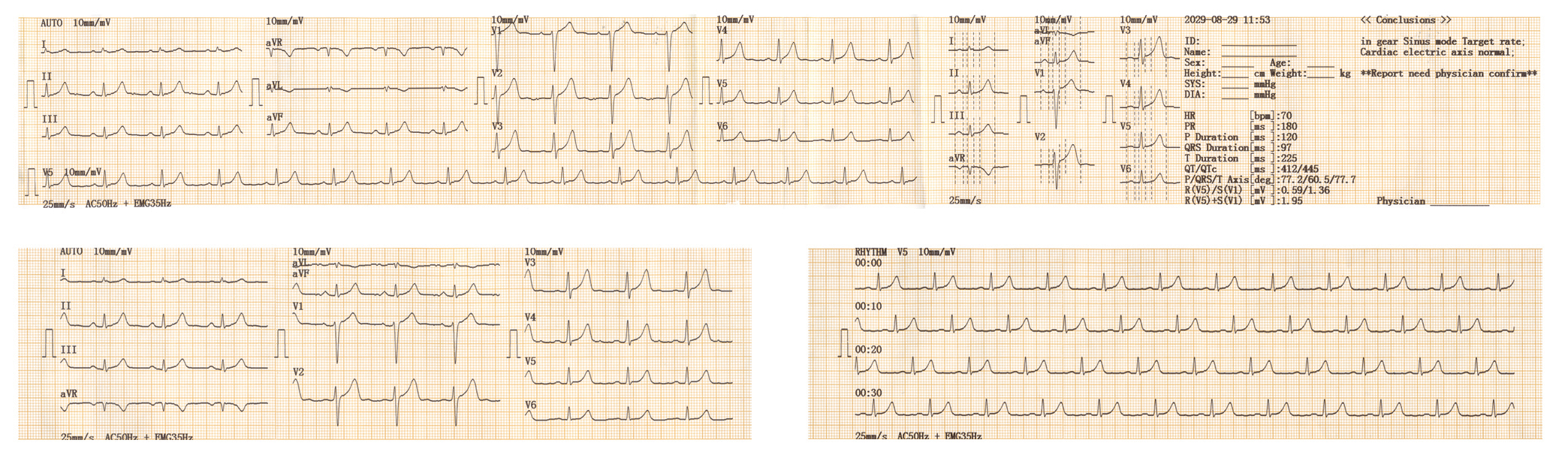 診斷報告輸出圖