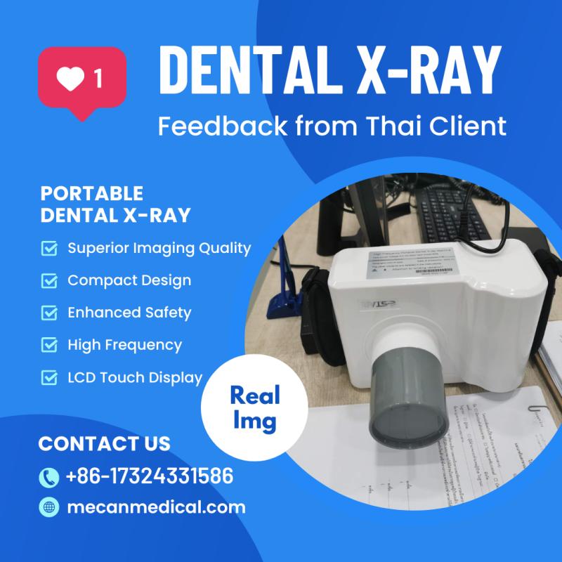 Oduševljenje Thai Client: MeCan Medical prenosivi zubni rendgenski snimak