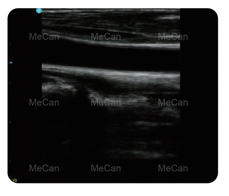 MeCan MCI0512 Portable Color Doppler Ultrasound excellent performance 3