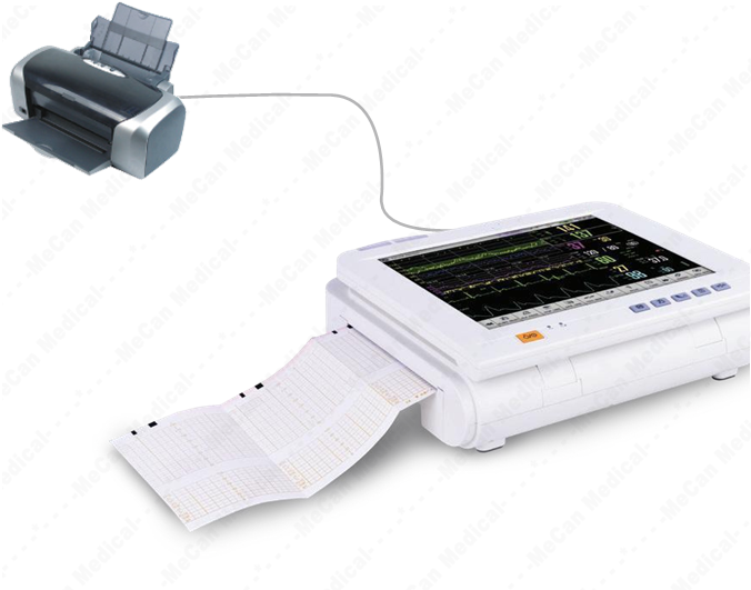 Fetal Maternal Monitor MCS0060 (10)