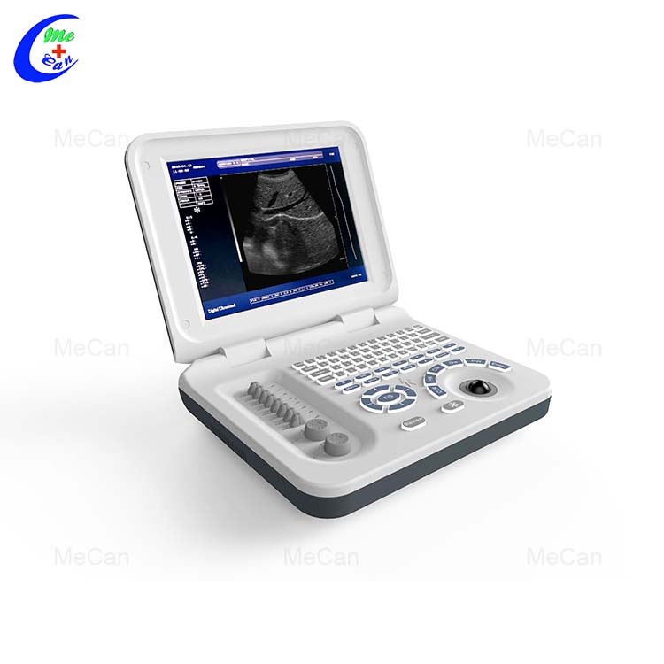 Laptop Ultrasound - Portable and Efficient
