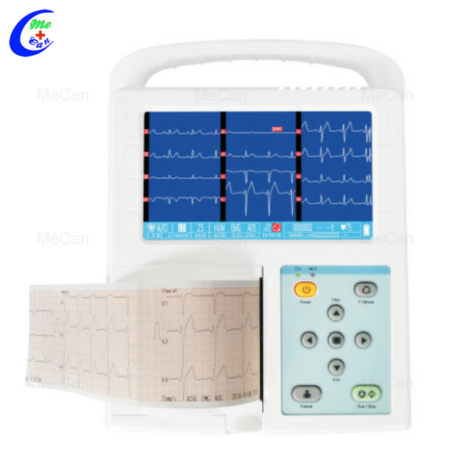 Resting ECG: Precise Heart Health Diagnosis & Monitoring