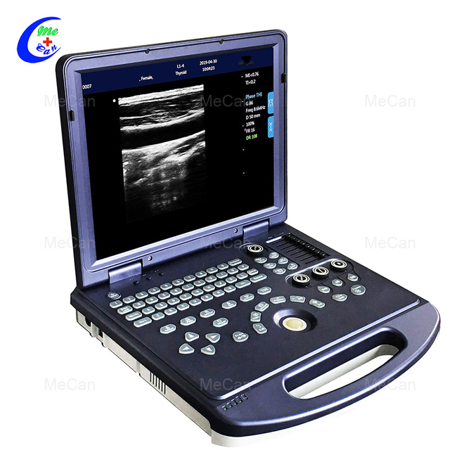 Macchina portatile per ultrasuoni in bianco e nero