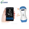 WiFi Wireless Probe Type Ultrasound Scanner
