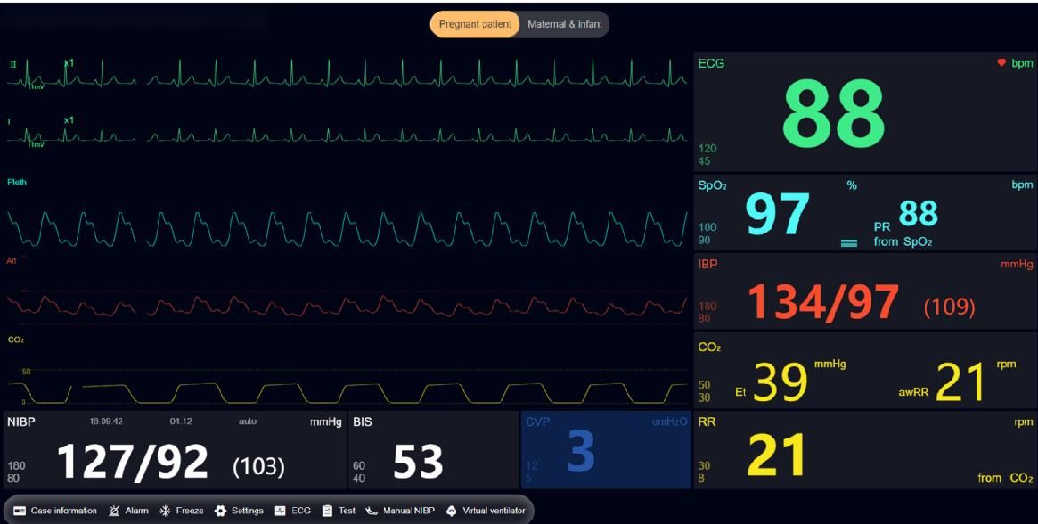 Ծննդաբերության առաջադեմ սիմուլյատոր, որը ցույց է տալիս իրական ժամանակի սինխրոնիզացված մայր-պտղի կենսական նշանների մոնիտորինգ մանկաբարձական ուսուցման համար