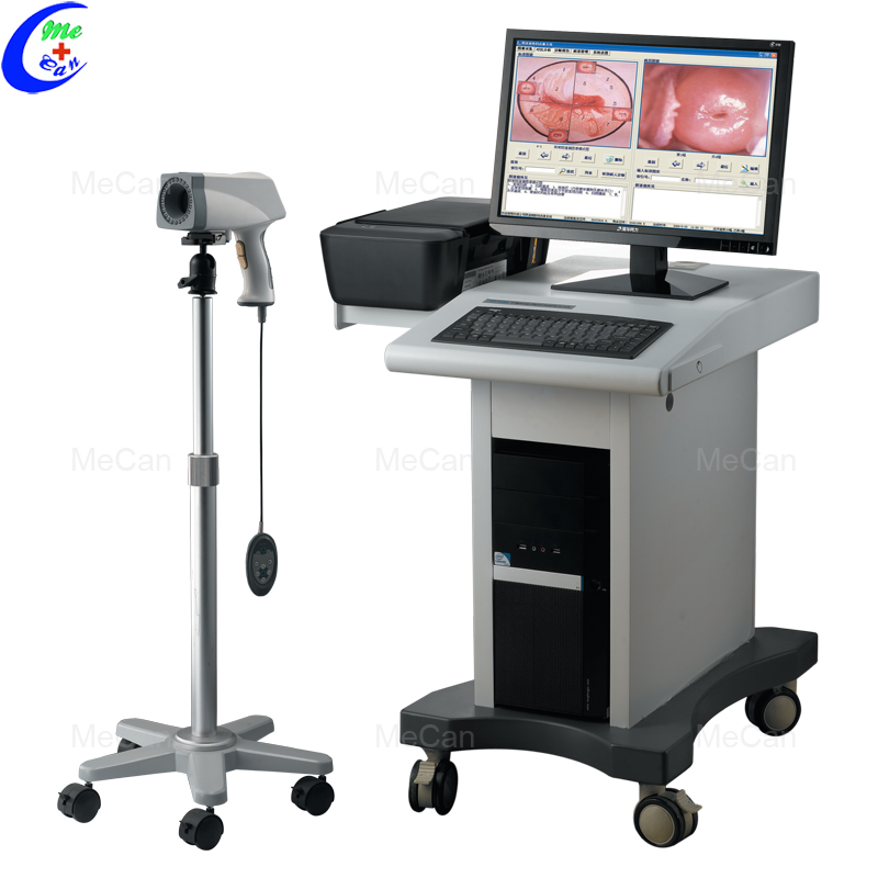 Quality High Quality Trolley Digital HD Video Colposcope for Gynecology Manufacturer | MeCan Medical
