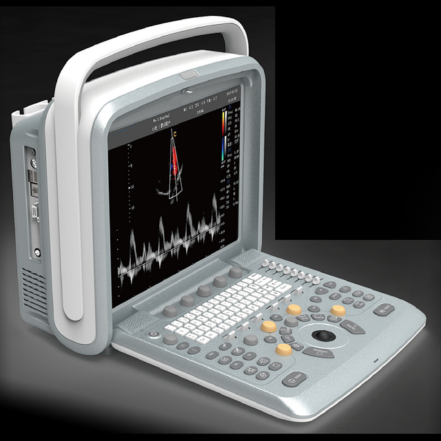 Profesionāla sirds atbalss pārnēsājama Ķīnas Doplera ultraskaņas iekārta grūtniecības ražotājiem