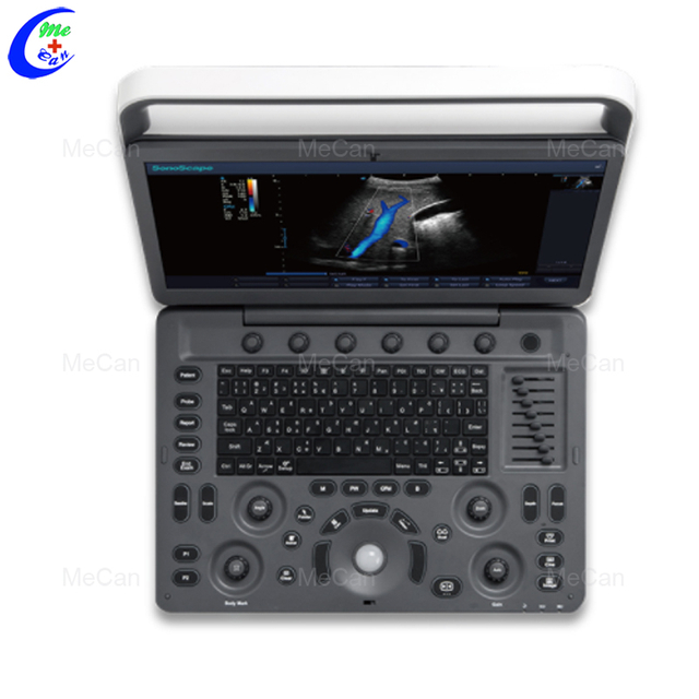 Labākā pārnēsājamā ultraskaņas iekārta, digitālā krāsu doplera Sonoscape E2 ultraskaņas kompānija — MeCan Medical