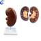 Kineski proizvođači modela bubrega ljudske anatomije - MeCan Medical