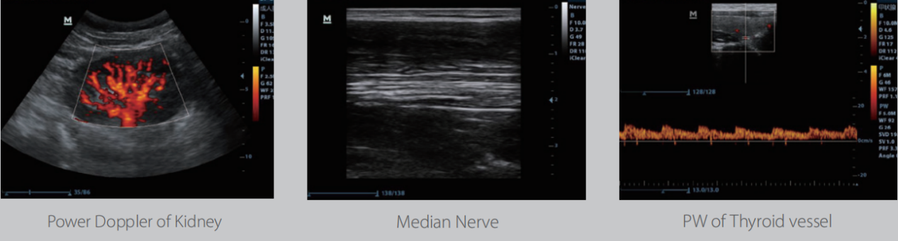 Mindray DP-30 Ultrasound System1