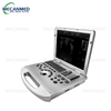 Portable Digital Color Doppler Ultrasound System