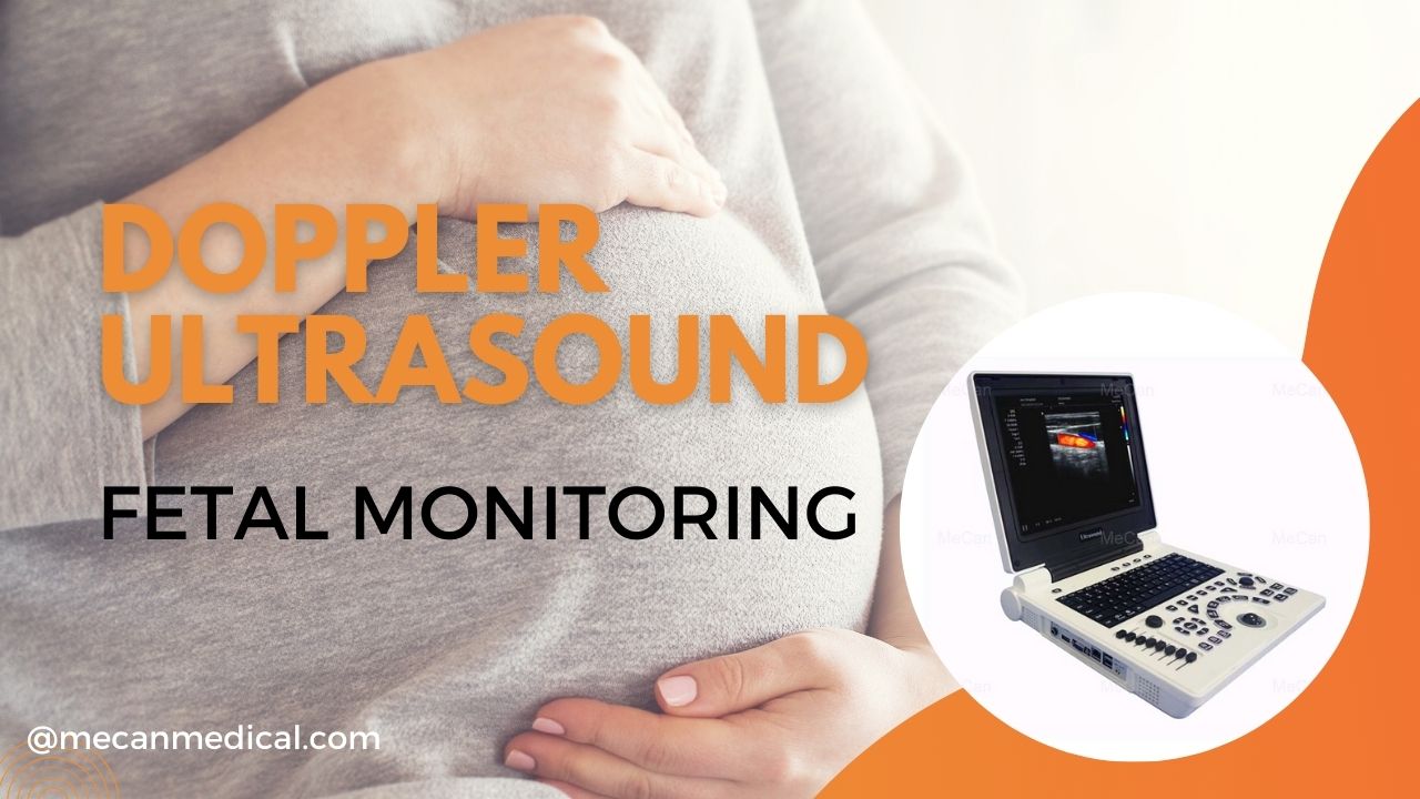 Pag-monitor sa Fetal nga adunay Doppler Ultrasound: Usa ka Komprehensibo nga Giya alang sa Nagpaabut nga mga Ginikanan