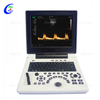 Full Digital Color Doppler Diagnostic System