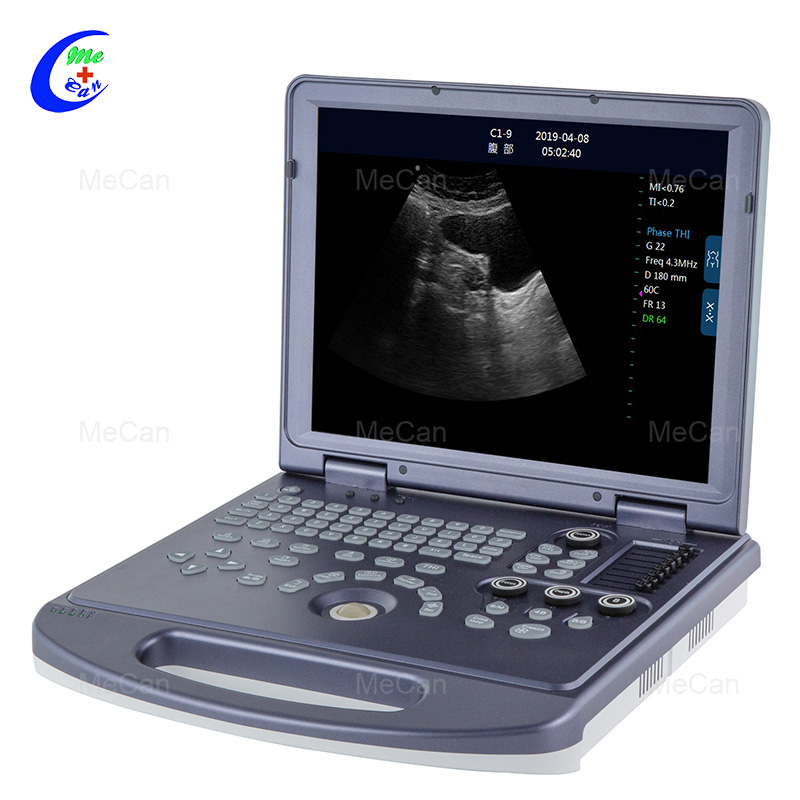 Portable Black and White Ultrasound Machine