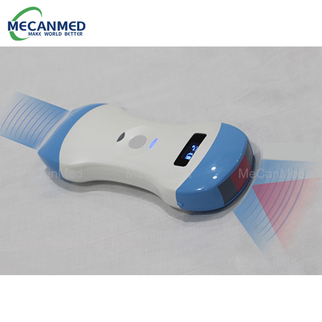 סורק אולטרסאונד WiFi נייד