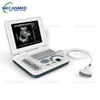 Portable Ultrasound Scanner | Digital Ultrasound Machine