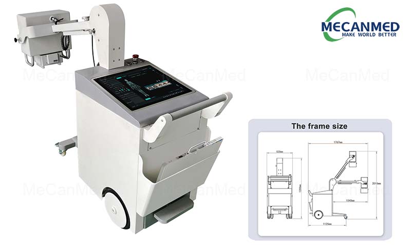 32KW Mobile X-ray Machine by MeCanMed
