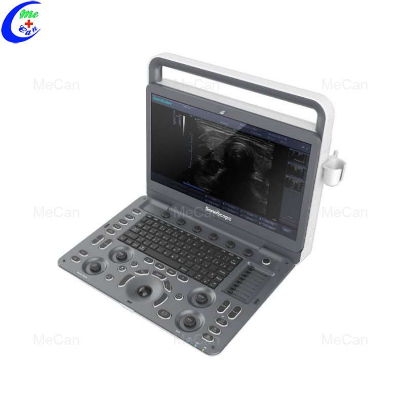 Best Portable Ultrasound Machine, Digital Color Doppler Sonoscape E2 Ultrasound Company - MeCan Medical