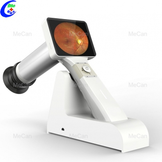 Professional Ophthalmic Handheld Portable Digital Eye Exam Fundus Camera manufacturers