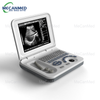 Portable Ultrasound Scanner | Digital Ultrasound Machine