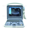 Full Digital Ultrasonic Diagnostic System