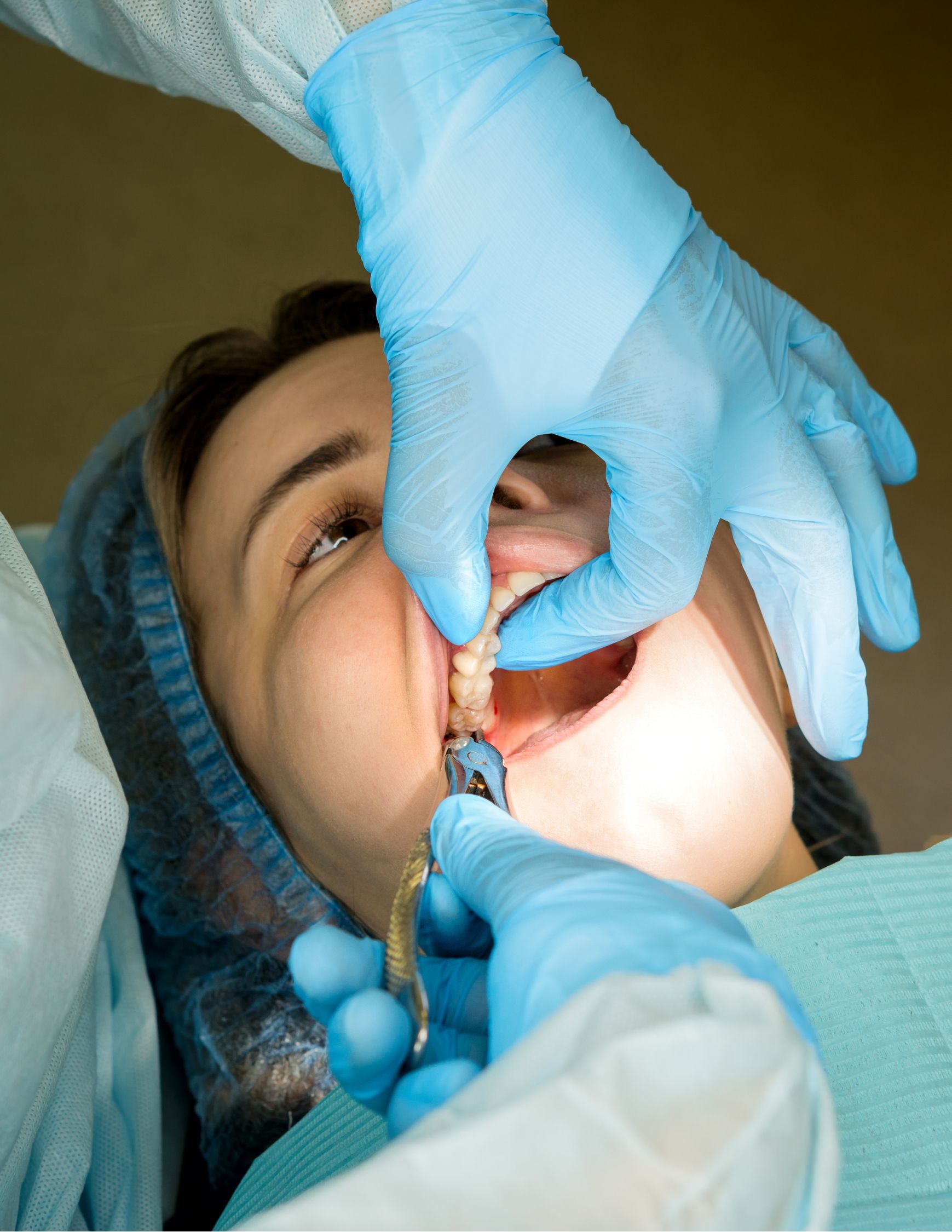 Remote installation (2)