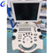 Beste ziekenhuis medische zwart-wit echografiemachinewagen Mobiele digitale echografiescanner Machinebedrijf - MeCan Medical