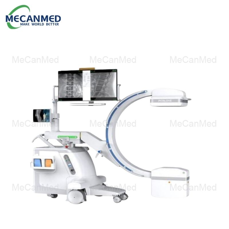 5KW Mobile Digital FPD C-arm X-ray System (1)