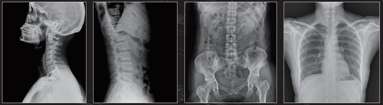 MCI0402 X Ray Machine Hulagway (8)