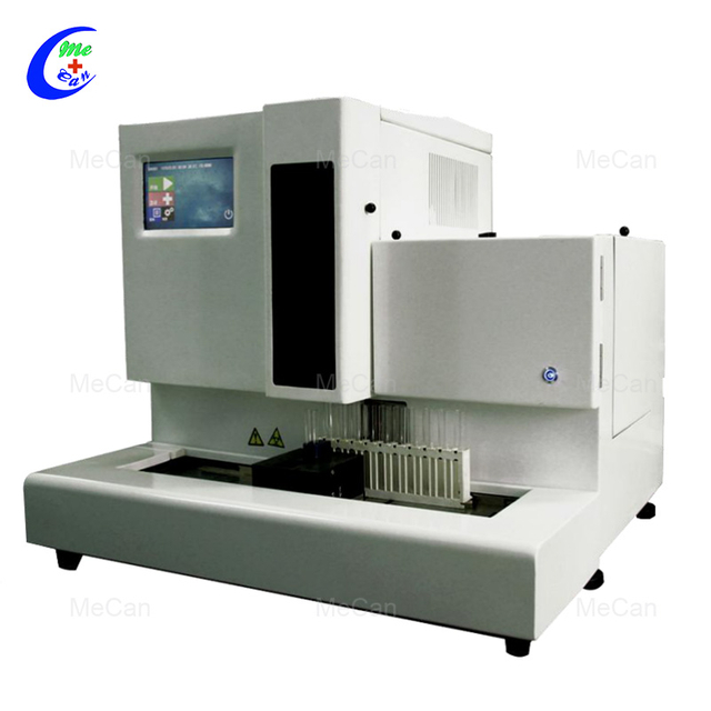 Automatick&yacute; analyz&aacute;tor ch&eacute;mie moču