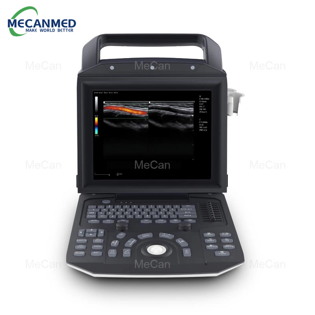 Professional Full Digital Color Doppler Ultrasonic Diagnostic System, Portable Ultrasonic Scanner manufacturers