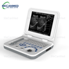 Portable Ultrasound Scanner | Digital Ultrasound Machine