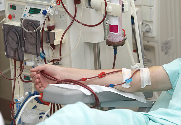 Menaxhimi i anemisë me aparatet e hemodializës: Rivendosja e niveleve të shëndetshme të hemoglobinës