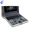 Portable Color Doppler Ultrasound Machine