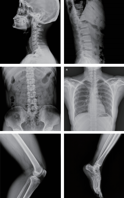 The&nbsp;Dynamic FPD System