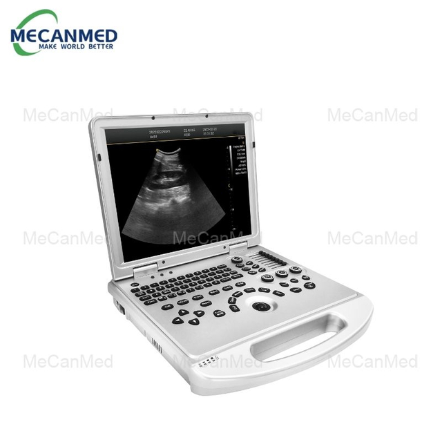 Portable Digital Color Doppler Ultrasound System