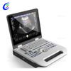 Scanner a ultrasuoni Color Doppler portatile per laptop
