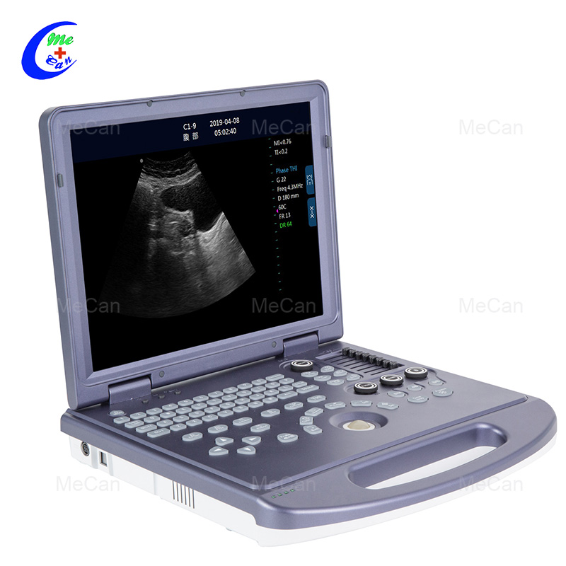 Portable Laptop Color Doppler Ultrasound Scanner