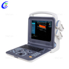 Portable Ultrasound Scanner | Digital Ultrasound Machine