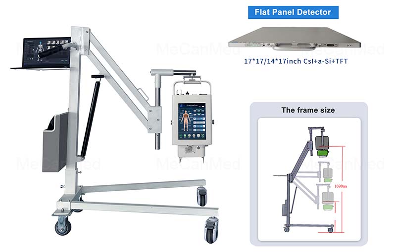 5.6kW MX-DR056A16 X Ray Machine1