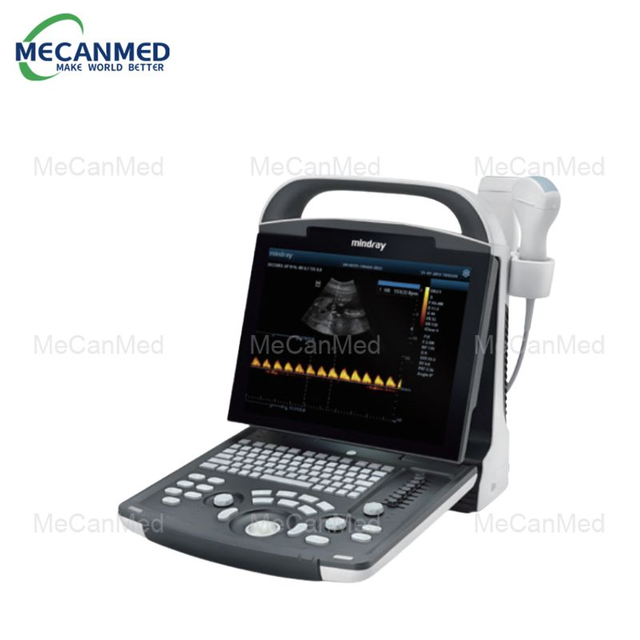 Mindray DP-10 Portable Digital Ultrasound System