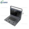 Portable Ultrasound Machine-Colour Doppler Ultrasound