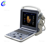 Portable Color Doppler Ultrasound Machine