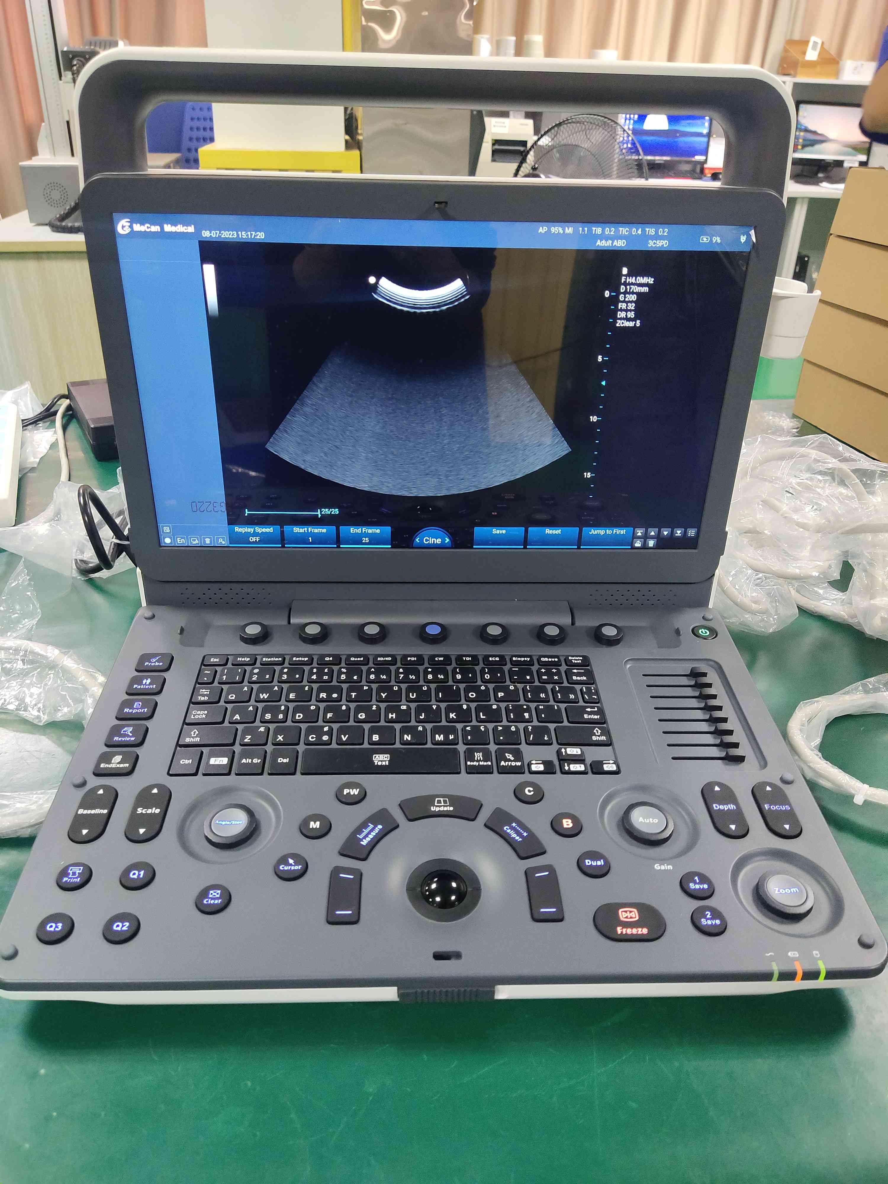 Portable ultrasound export to healthcare facility in Cameroon
